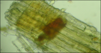 Microscopy of the heartwood of Cedrus deodara that show presence of Collenchyma Xylem parenchyma 