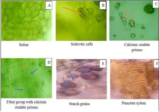 Microscopic elements of root powder (Magnification X 40) Microscopic elements of root powder (Magnification X 40)